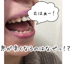 なぜ息は臭くなるのでしょうか?
